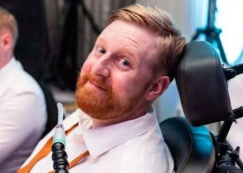 Lamtumirë e parakohshme! Ndahet nga jeta në moshën 35-vjeçare aktori i Game of Thrones